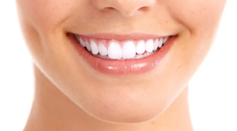 El contorneado dental, ¿qué es y para qué sirve?