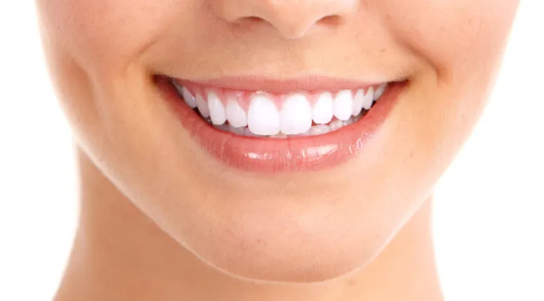 El contorneado dental, ¿qué es y para qué sirve?