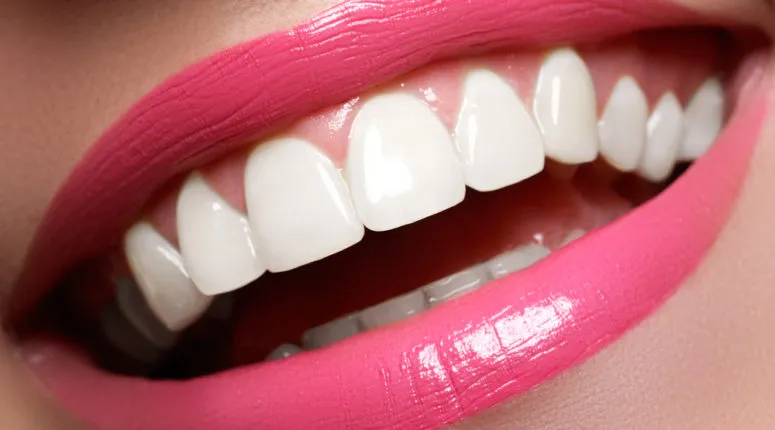 ¿Dientes amarillos? Cómo lucir una sonrisa más blanca.